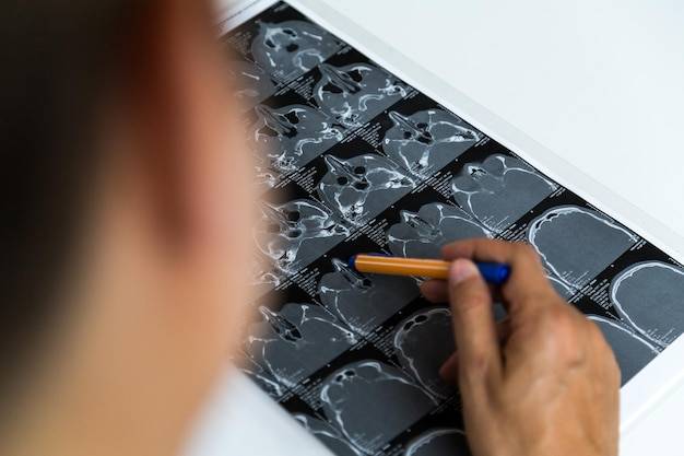 Badanie RTG kręgosłupa jak się przygotować do wizyty?