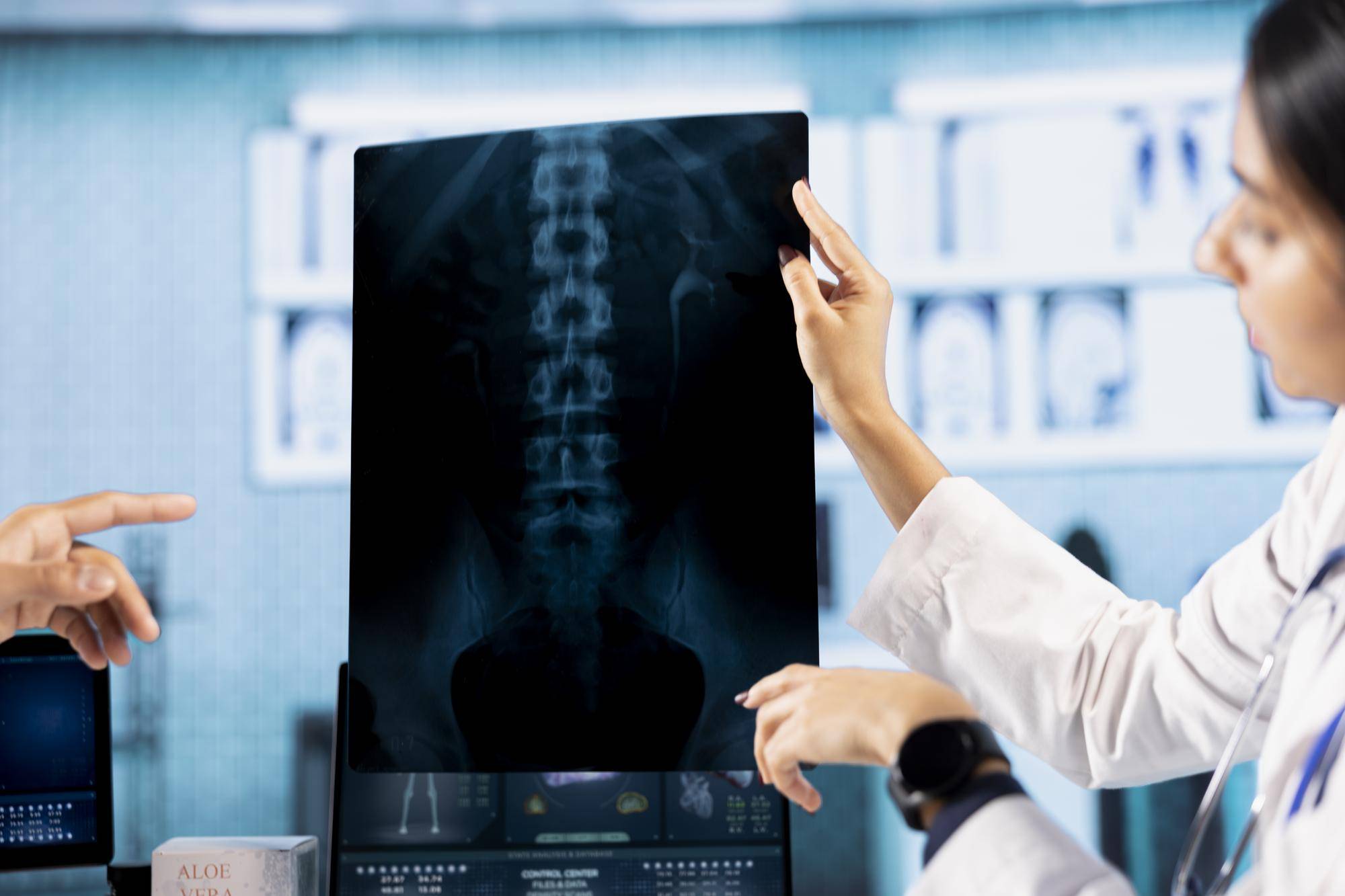 Jak się robi prześwietlenie kręgosłupa w gabinecie radiologicznym?